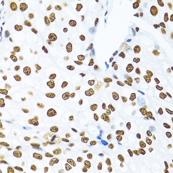 Anti-KHDRBS1 Antibody (CAB6101)