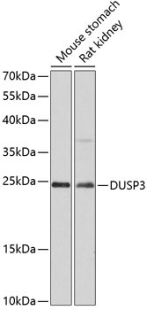 Anti-DUSP3 Antibody (CAB12068)