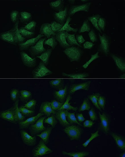 Anti-REXO2 Antibody (CAB15808)