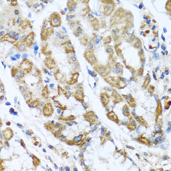 Anti-ANTXR2 Antibody (CAB6526)