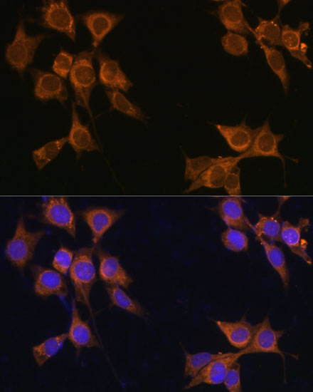 Anti-CD133 Antibody [KO Validated] (CAB12711)