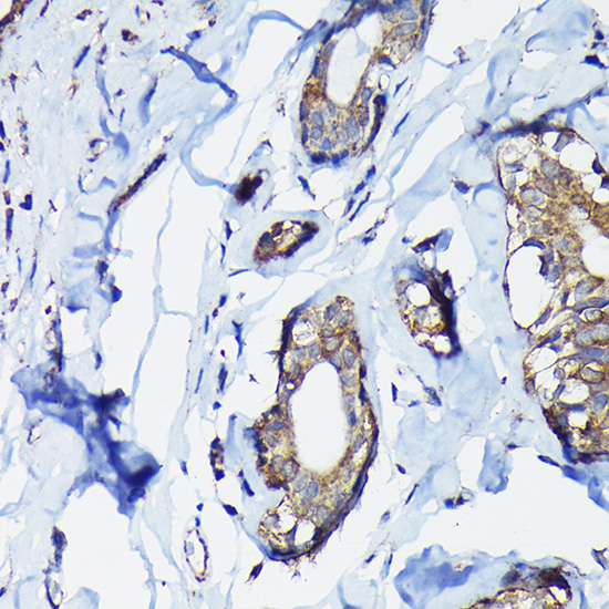 Anti-PEG10 Antibody (CAB2787)