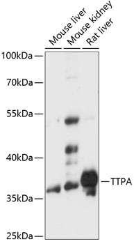 Anti-TTPA Antibody (CAB14473)