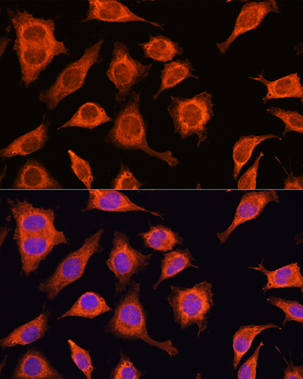 Anti-DAAM2 Antibody (CAB7463)