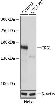 Anti-CPS1 Antibody [KO Validated] (CAB19978)