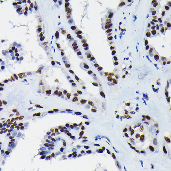 Anti-HDGF Antibody (CAB13654)