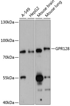 Anti-GPR128 Antibody (CAB14431)