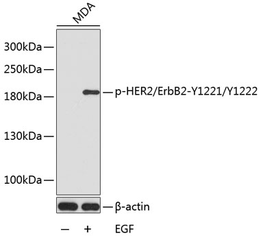 Anti-Phospho-ERBB2-Y1221/Y1222 Antibody (CABP0149)