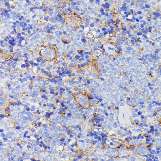 Anti-SNAP23 Antibody (CAB13909)