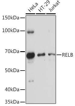 Anti-RELB Antibody (CAB0519)