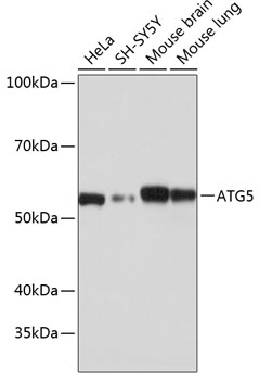 Anti-ATG5 Antibody [KO Validated] (CAB19677)