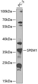 Anti-SPEM1 Polyclonal Antibody (CAB8076)