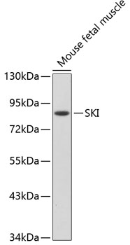 Anti-SKI Antibody (CAB2879)