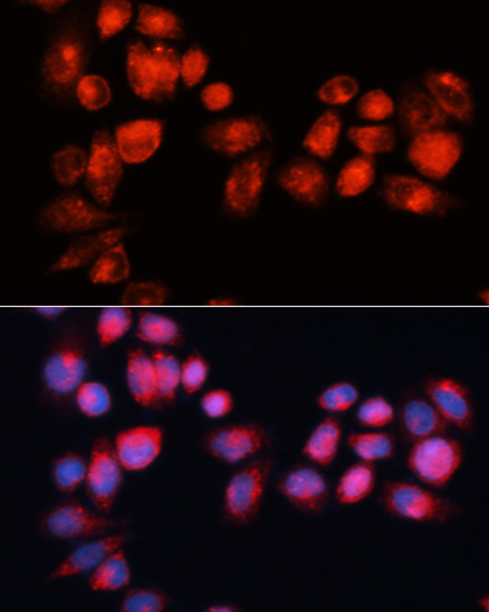 Anti-ABCB7 Antibody (CAB14699)