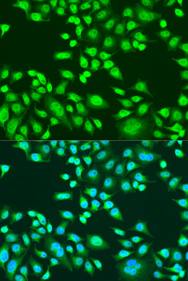 Anti-PAX8 Antibody (CAB1009)