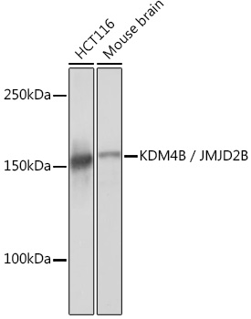 Anti-KDM4B / JMJD2B Antibody (CAB6670)