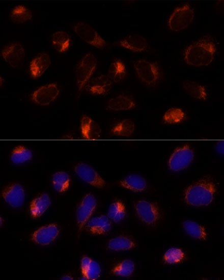 Anti-TXNDC12 Antibody (CAB14403)