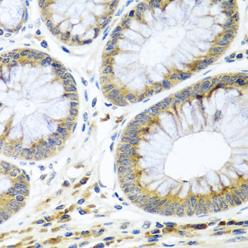 Anti-WNT9A Antibody (CAB7939)