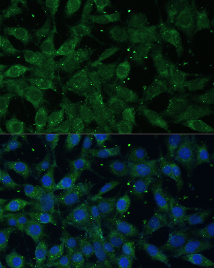 Anti-NF-kB p65 Antibody (CAB2547)