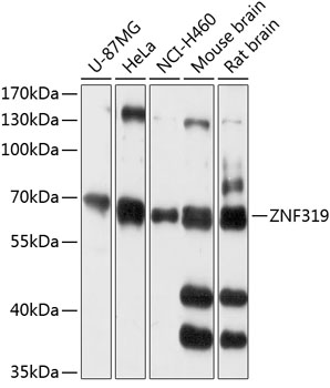 Anti-ZNF319 Antibody (CAB14324)