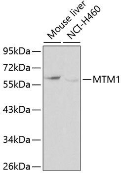 Anti-MTM1 Antibody (CAB0255)