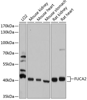 Anti-FUCA2 Antibody (CAB12211)