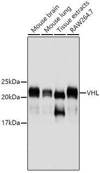 Anti-VHL Mouse Monoclonal Antibody (CAB11872)