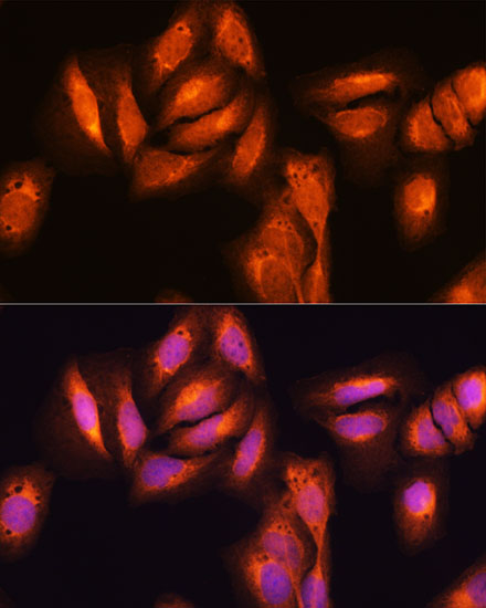 Anti-NF-kB p65 Antibody (CAB11204)