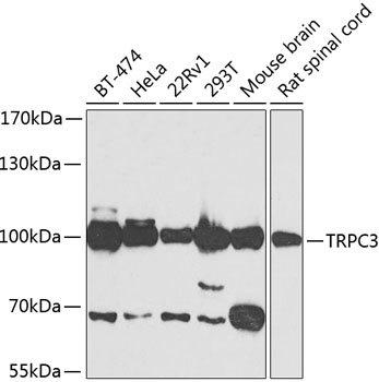 Anti-TRPC3 Antibody (CAB7742)