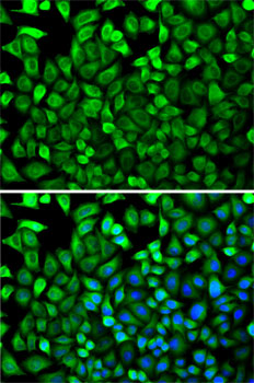 Anti-CDA Antibody (CAB13959)