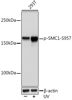 Anti-Phospho-SMC1-S957 Antibody (CABP1145)