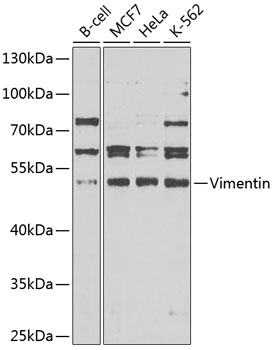 Anti-Vimentin Antibody (CAB11423)