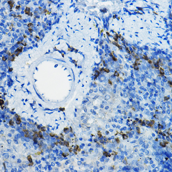 Anti-Beta-TRCP Antibody (CAB1656)