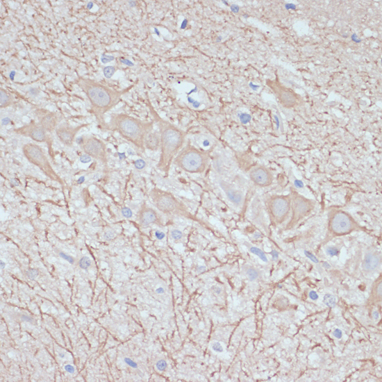 Anti-Map2 Antibody (CAB17409)