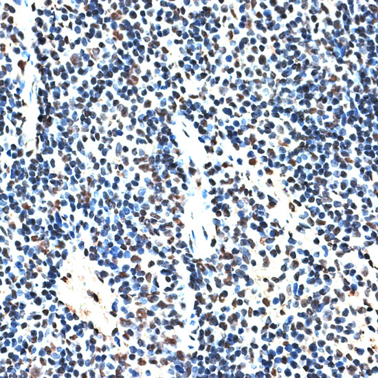 Anti-RBM17 Antibody (CAB3240)