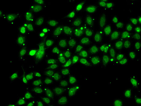 Anti-ACTL6B Antibody (CAB7108)