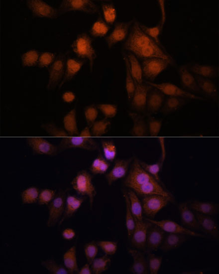 Anti-Twist Antibody (CAB7314)