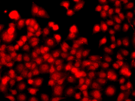 Anti-THAP1 Antibody (CAB7472)