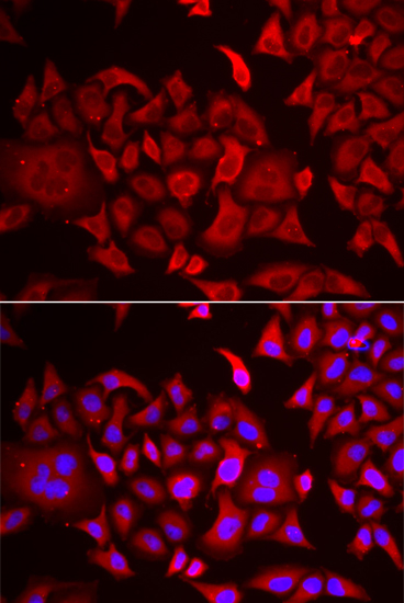 Anti-TARS Antibody (CAB6993)