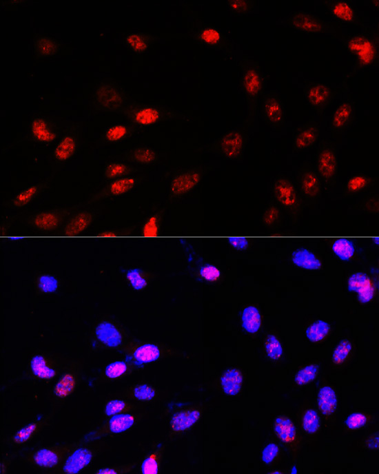 Anti-TCF4 Antibody (CAB1141)