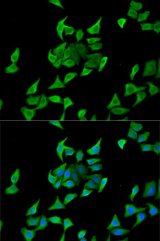 Anti-HPX Antibody (CAB5603)