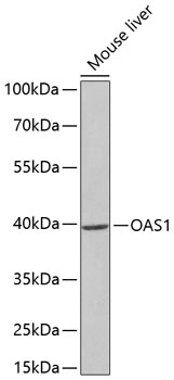 Anti-OAS1 Antibody (CAB2530)