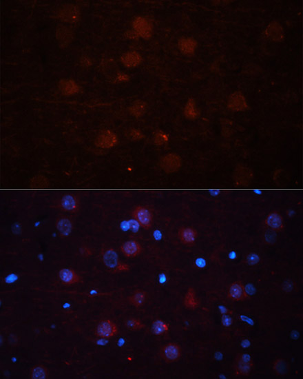 Anti-ASPN Antibody (CAB10311)