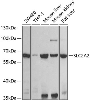 Anti-SLC2A2 Polyclonal Antibody (CAB9843)