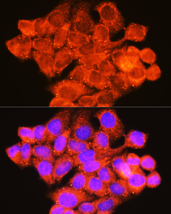 Anti-Raf1 Antibody (CAB0223)