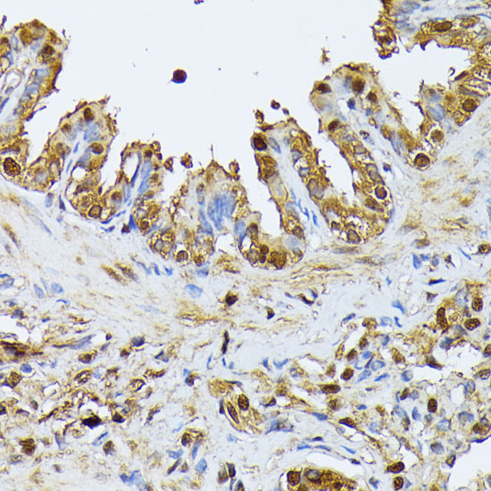 Anti-SMN1 Antibody (CAB16246)