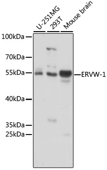 Anti-ERVW-1 Antibody (CAB16522)