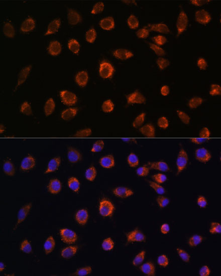 Anti-ARHGAP11B Antibody (CAB16587)