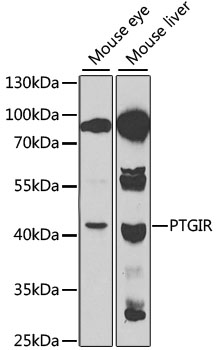 Anti-PTGIR Antibody (CAB1849)