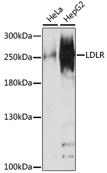 Anti-NUP210 Antibody (CAB16676)